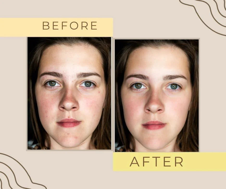 100% Original Zafrani Face Body Whitening Cream